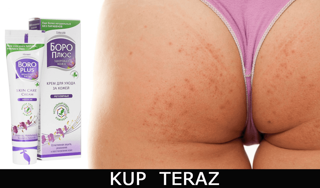 Krostki na pośladkach? Poznaj 3 kroki do gładkiej skóry!